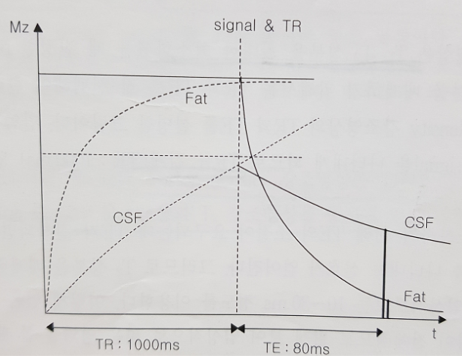 T2강조영상에서의 지방과 뇌척수액의 signal 변화에 대한 TR과 TE의 관계 사진
출처 : https://radiographer.tistory.com/13