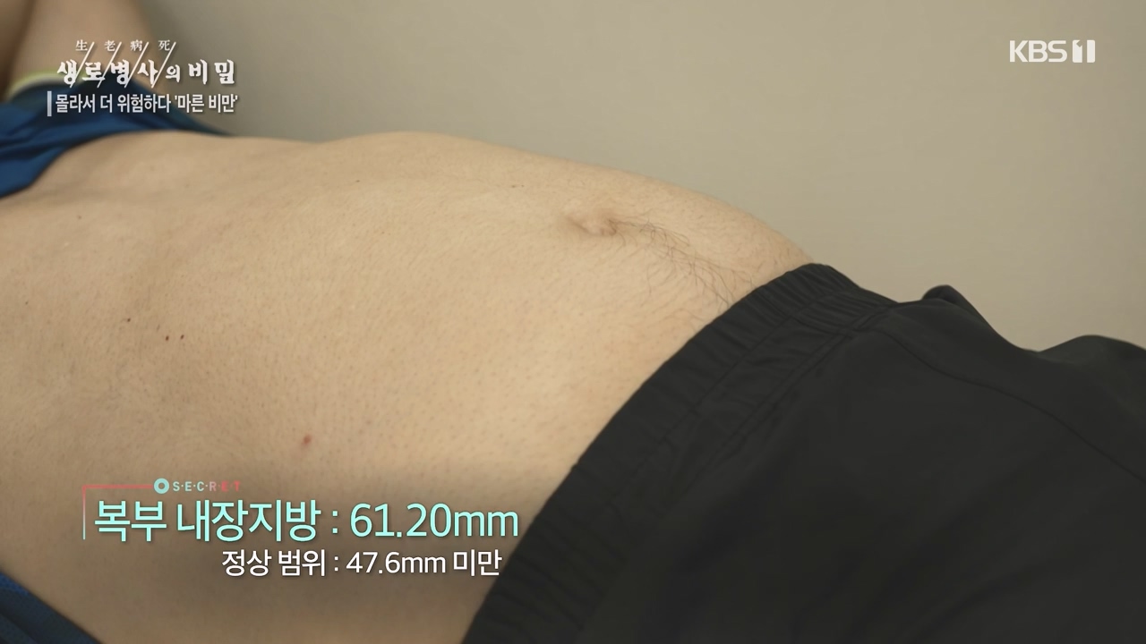 생로병사의 비밀.E889.231109p-NEXT.mp4_20231109_203829.898.jpg