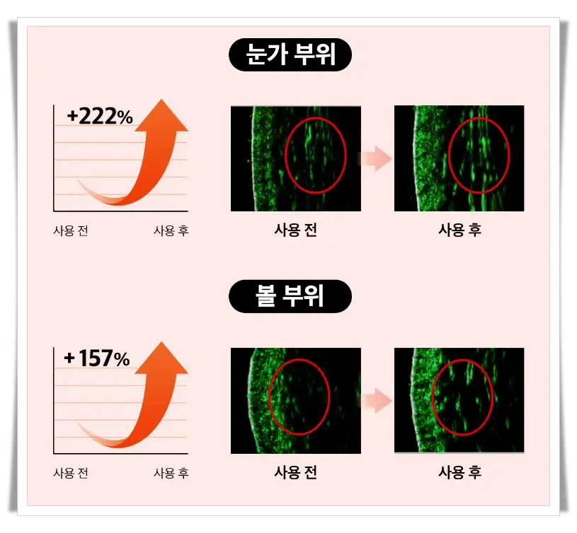 듀얼소닉 맥시멈 효과_피부 탄력 및 치밀도 개선