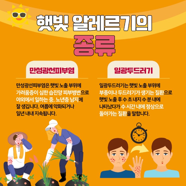 햇빛알레르기 종류