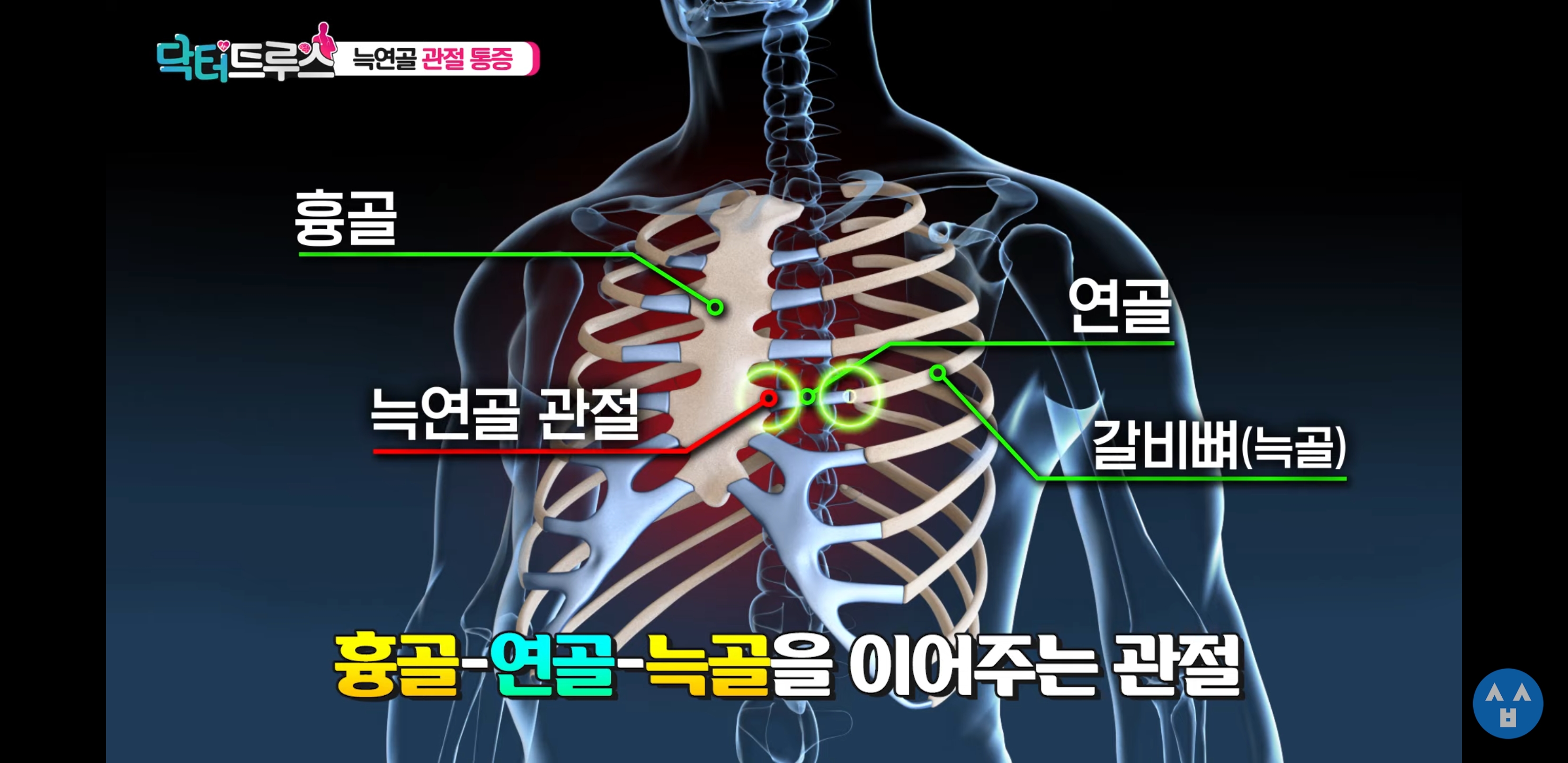  늑연골 관절 통증