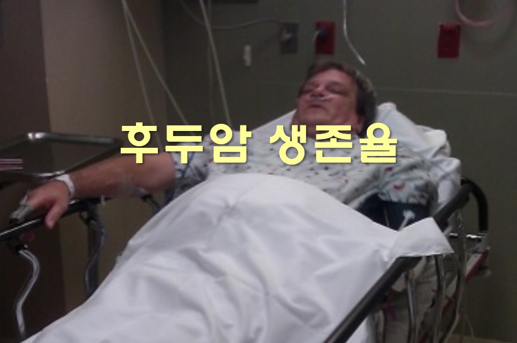  후두암 초기증상과 생존율
