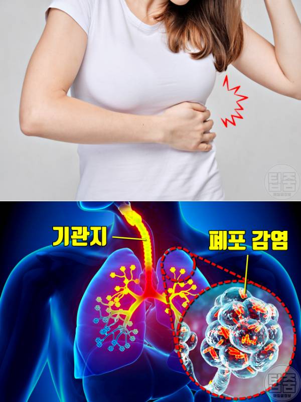 가슴통증 원인 증상 의심되는병 폐렴