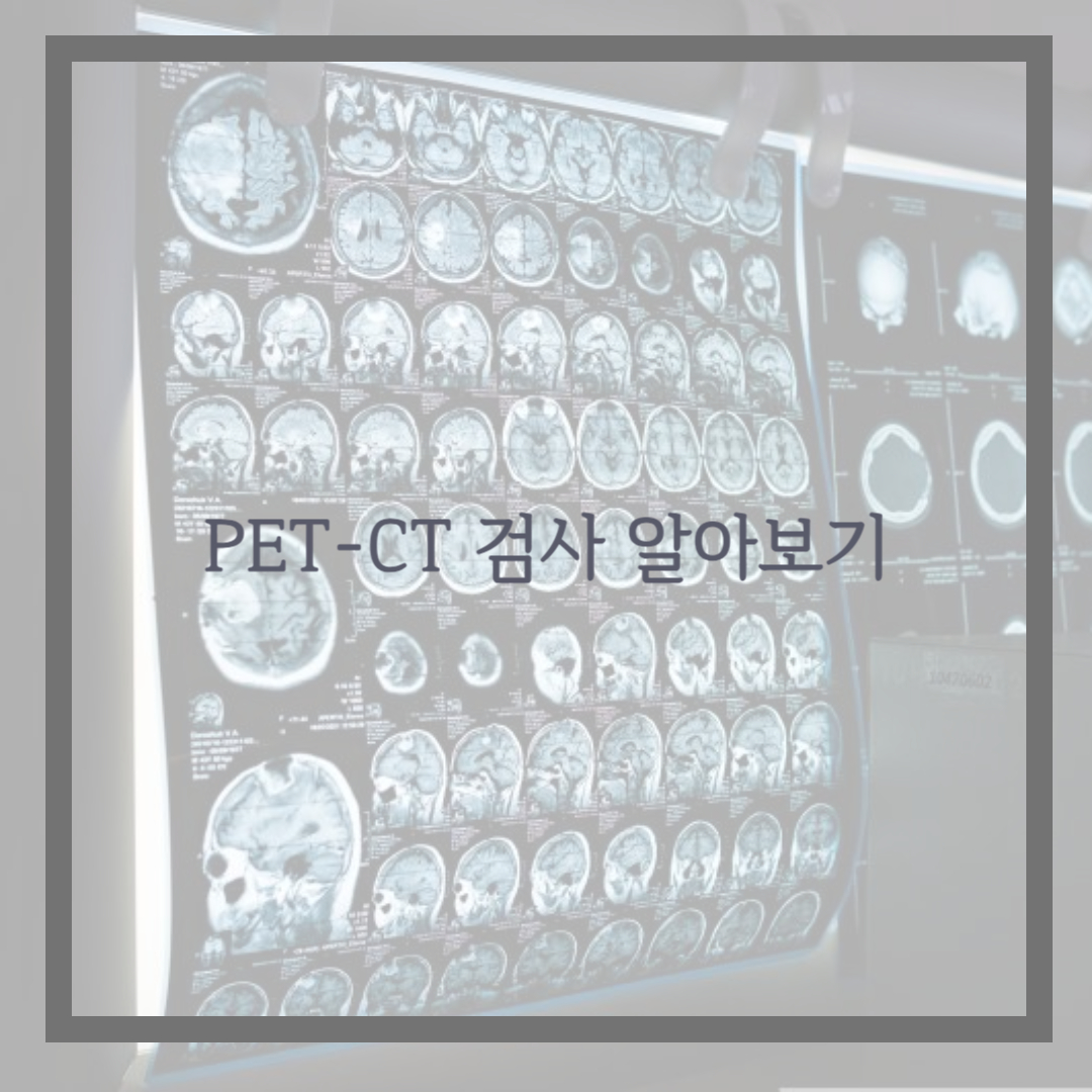 PET-CT 검사 알아보기