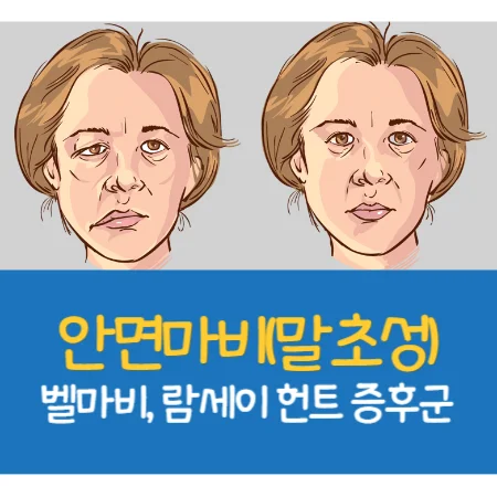 말초성 얼굴마비
벨마비
람세이 헌트 증후군