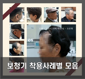 [일산 이편한보청기] 보청기 타입별 착용 사례 모음  : 일산 대화동 보청기