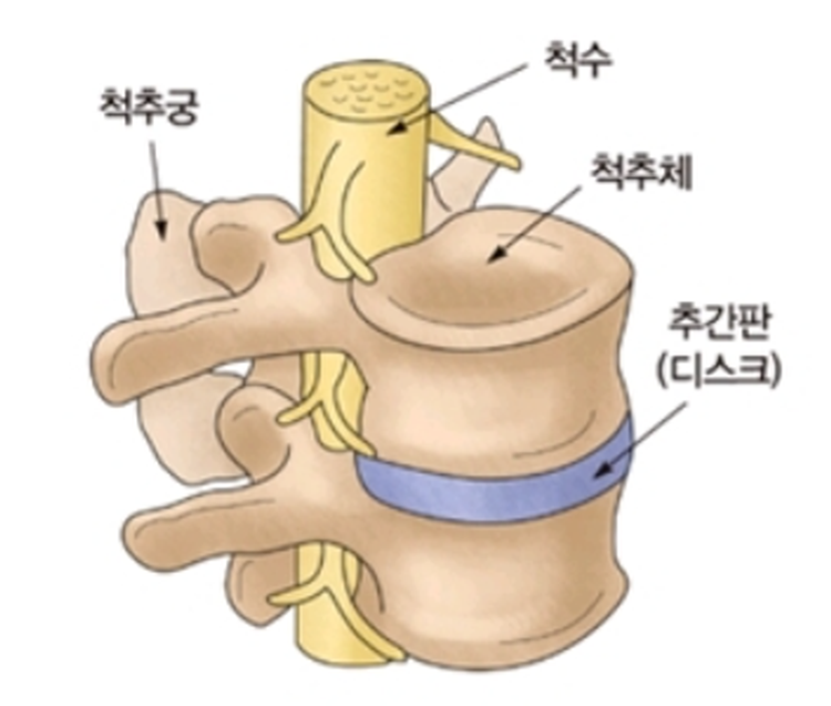 좌골신경통 증상