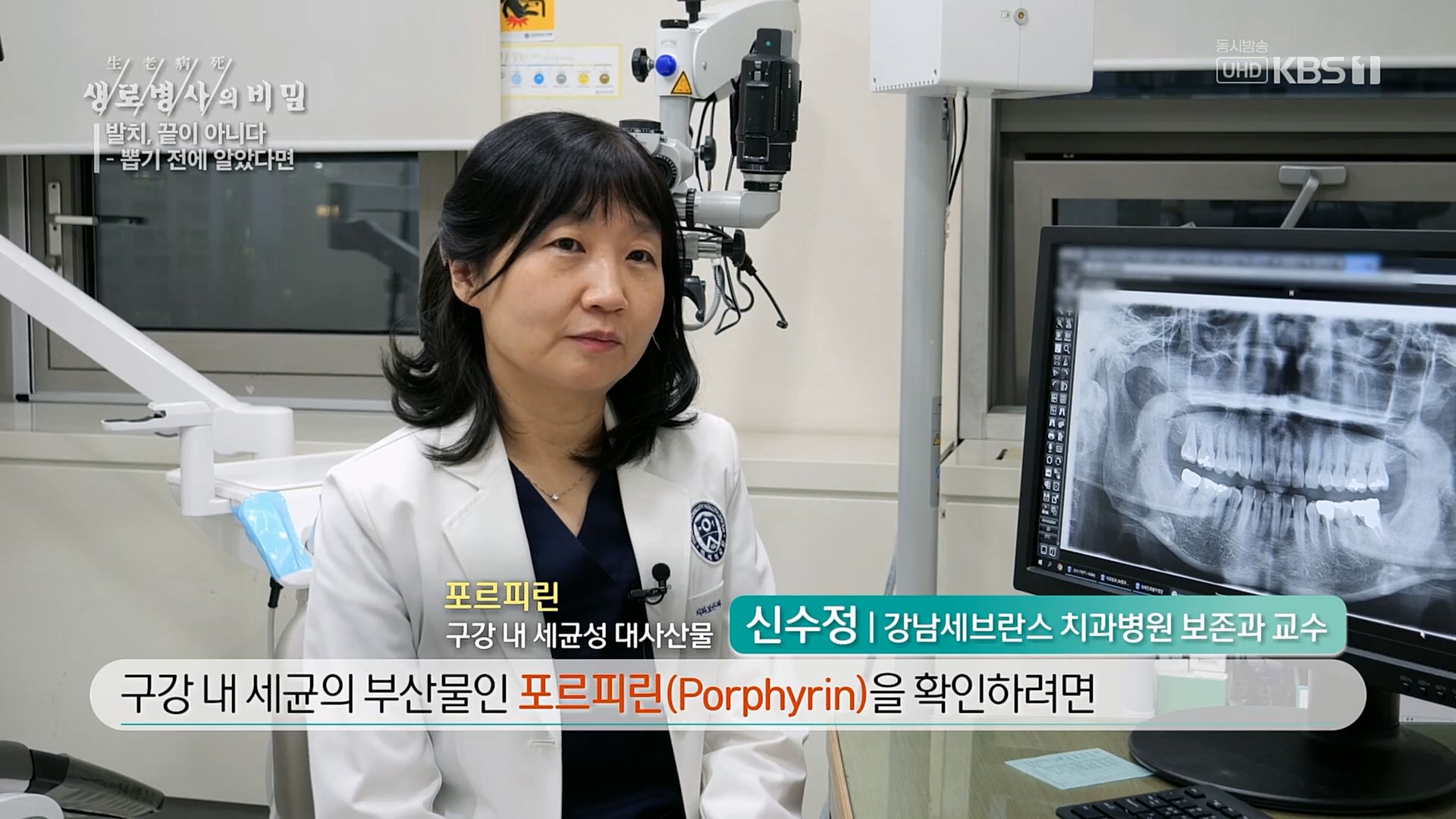 생로병사의 비밀.E855.230208p.H264-F1RST.mp4_20230214_194915.277.jpg
