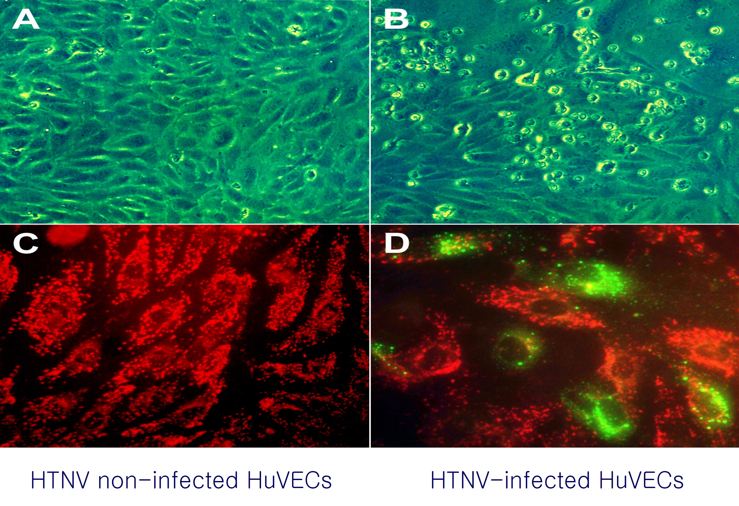 ICC of HTNV infected HuVECs