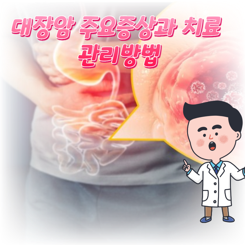  대장암 주요증상과 치료 관리방법