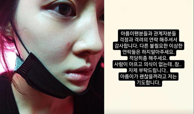  아름 이혼 소송, 진실은?