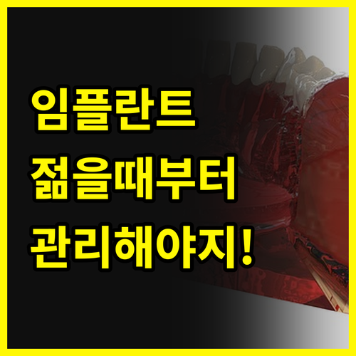 임플란트, 젊을 때부터 관리해야지!💪