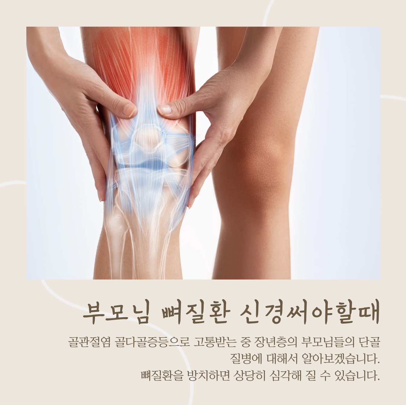 골다골증 엄마