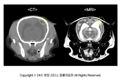 CT와 MRI의 차이