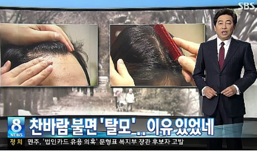 여름철 ′탈모′ 주의보…에어컨 사용, 두피에 해로운 영향