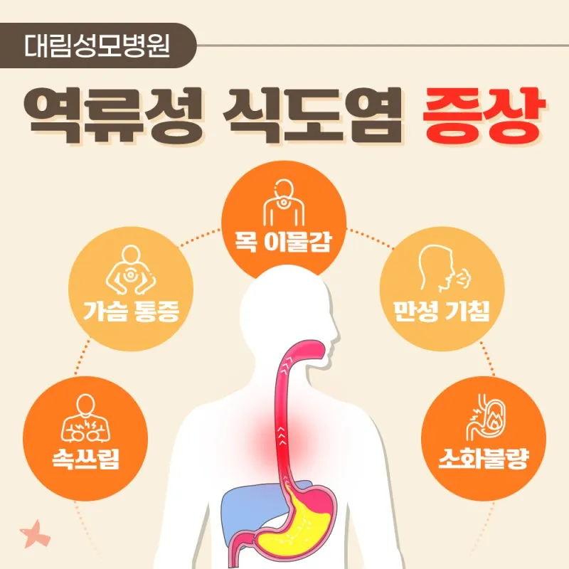 역류성 식도염 원인 초기증상 예방하는 방법_4