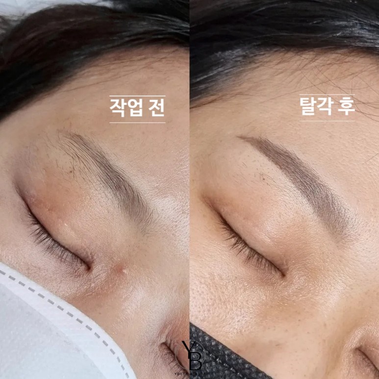  광주눈썹문신 잘하는곳 마무리 탈각까지 완벽해요