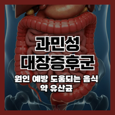 과민성대장증후군 증상, 과민성대장증후군 원인, 과민성대장증후군 치료법, 과민성대장증후군 좋은 음식, 장 건강, 스트레스와 장염, 과민성대장 치료법