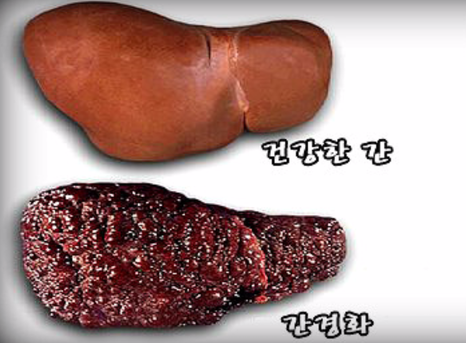 경화식품 이미지