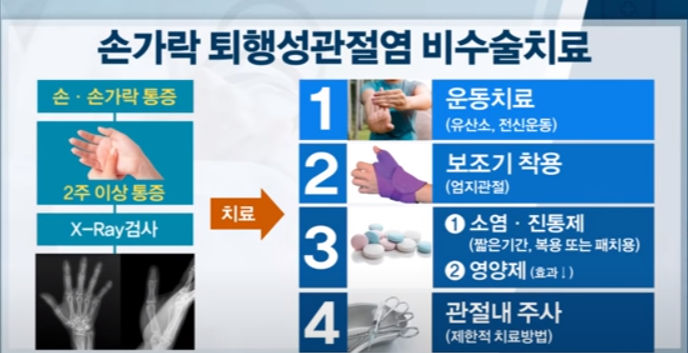 출처: 서울대병원TV(손가락 퇴행성 관절염 비수술)