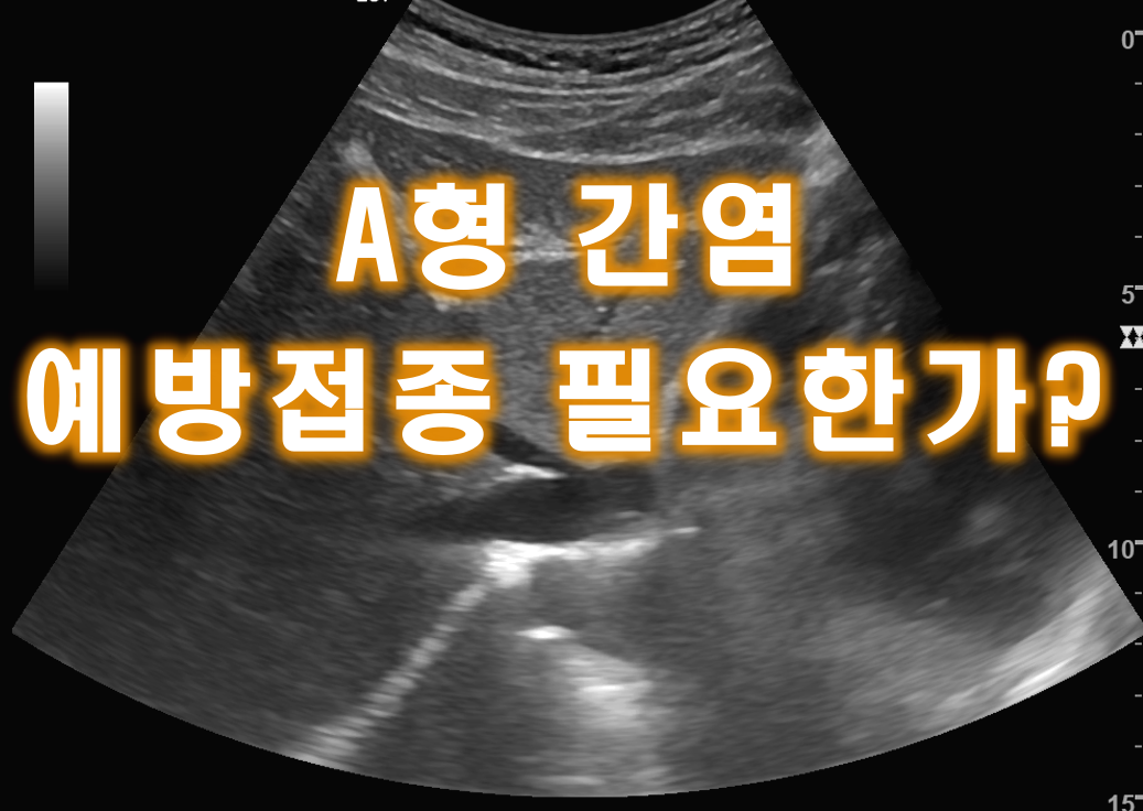  A형 간염 예방접종의 필요성