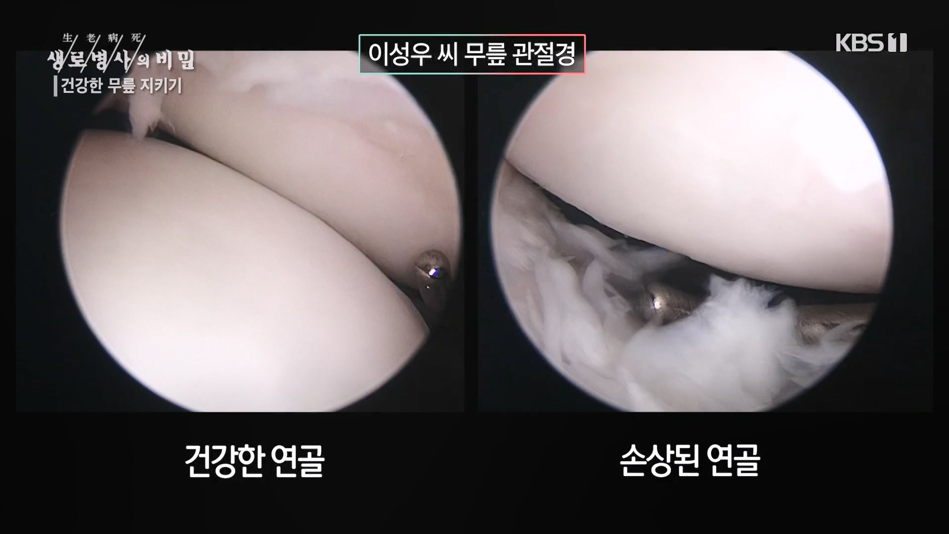 생로병사의 비밀.E873.230607p-NEXT.mp4_20230608_202209.887.jpg