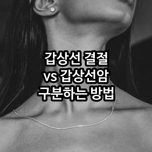 갑상선 결절 vs 갑상선암 구분하는 방법