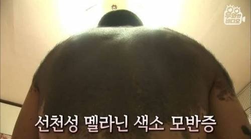  거대한 점을 가진 남자