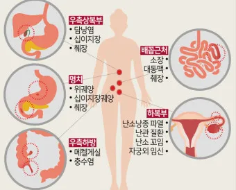 왼쪽 아랫배 통증 움질일때 콕콕 땡김_10
