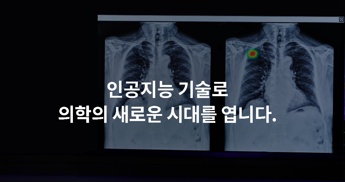  [신규상장] 루닛 주식전망 | 의료 AI 관련주 , 헬스케어 최초 기술특례 상장 최고 등급
