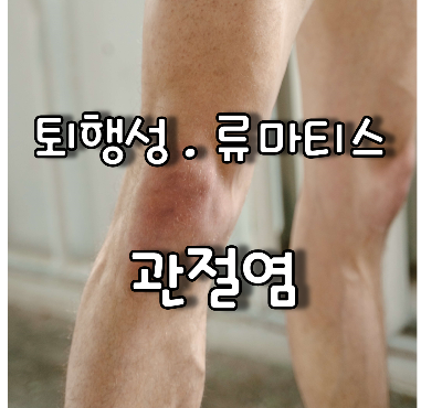 부어 오른 무릎