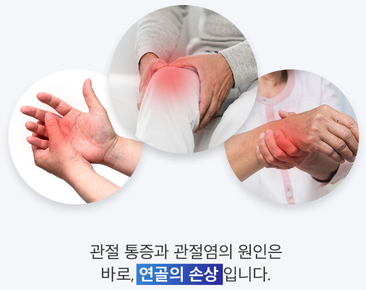 관절염의 원인-연골의 손상