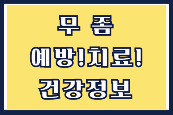 무좀 원인 증상 예방 및 치료방법 알아보기