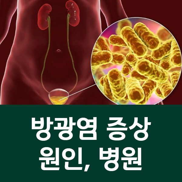 방광염 증상과 원인 병원 어디로 가야할까'