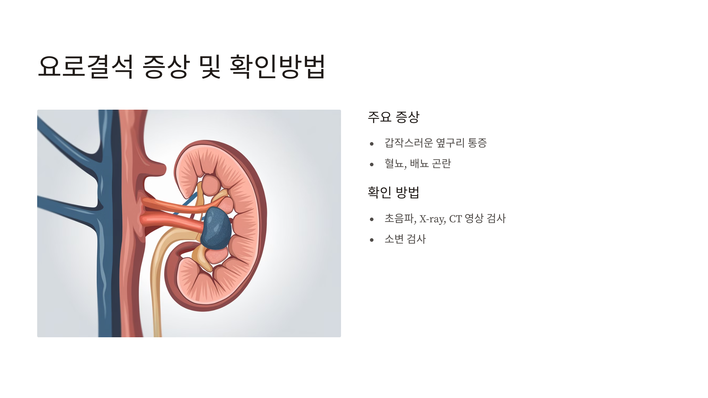 요로결석 증상 및 확인방법