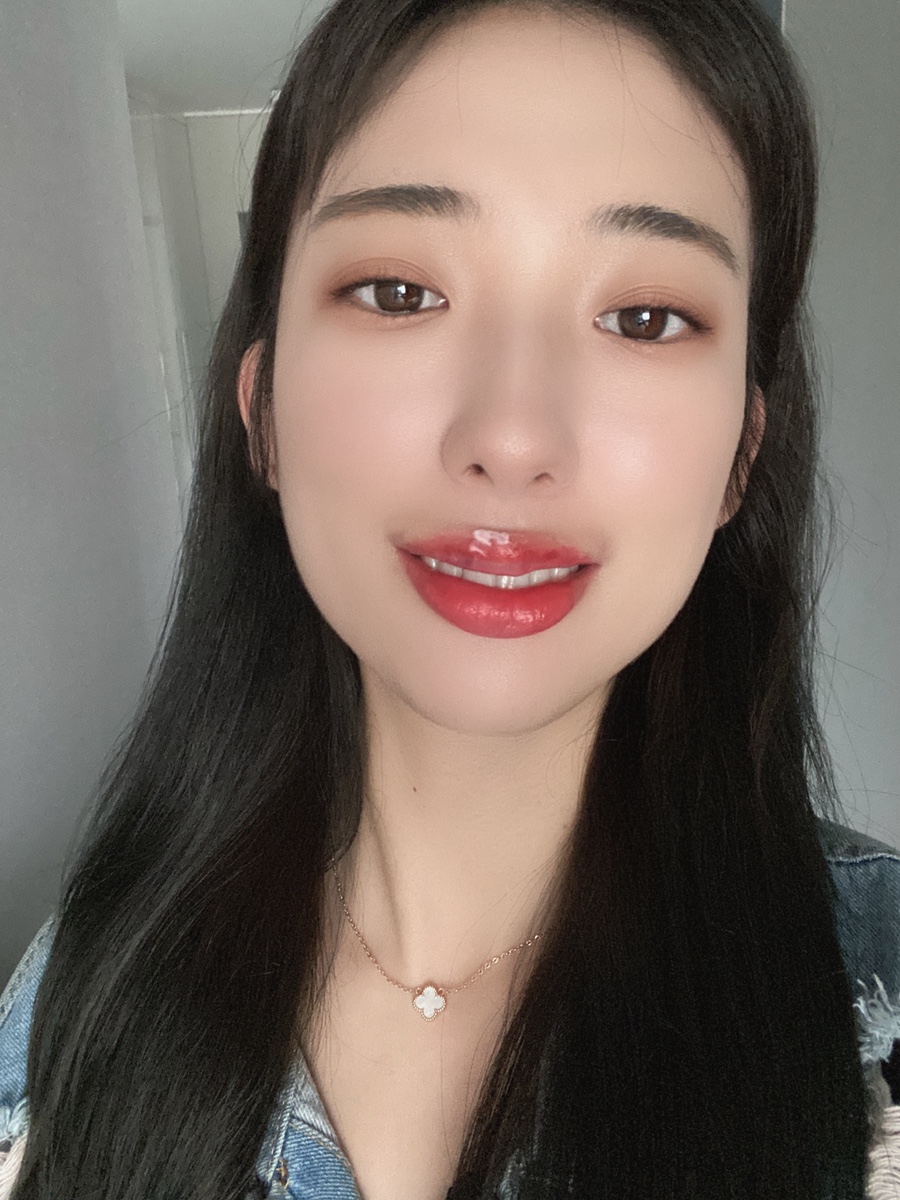 입술 보톡스 부작용 대전 입술필러+입꼬리보톡스 내돈내산 10