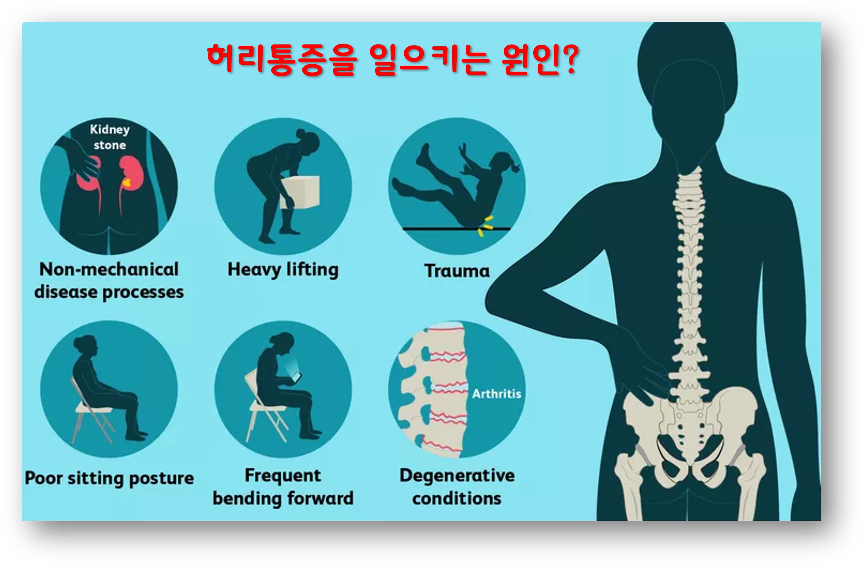 일상속 허리통증을 일으키는 요소 / 원인