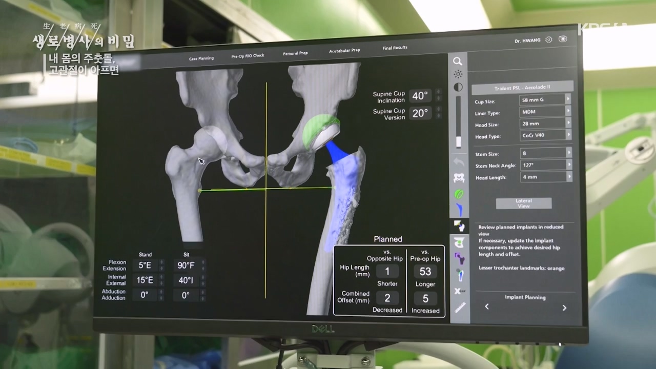생로병사의 비밀.E890.231116p-NEXT.mp4_20231116_204856.392.jpg