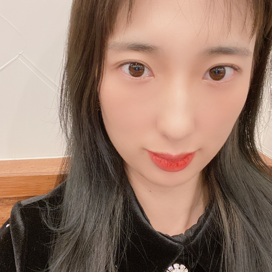 입술 보톡스 부작용 대전 입술필러+입꼬리보톡스 내돈내산 7