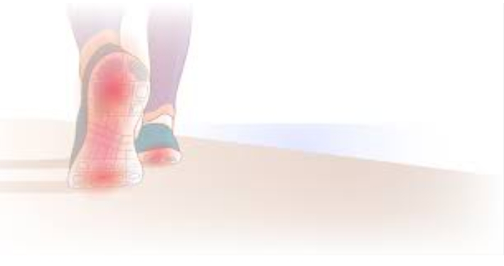 발바닥 통증 스트레칭 및 치료법2