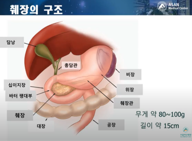  췌장암 초기증상, 초반에 잡으면 승산