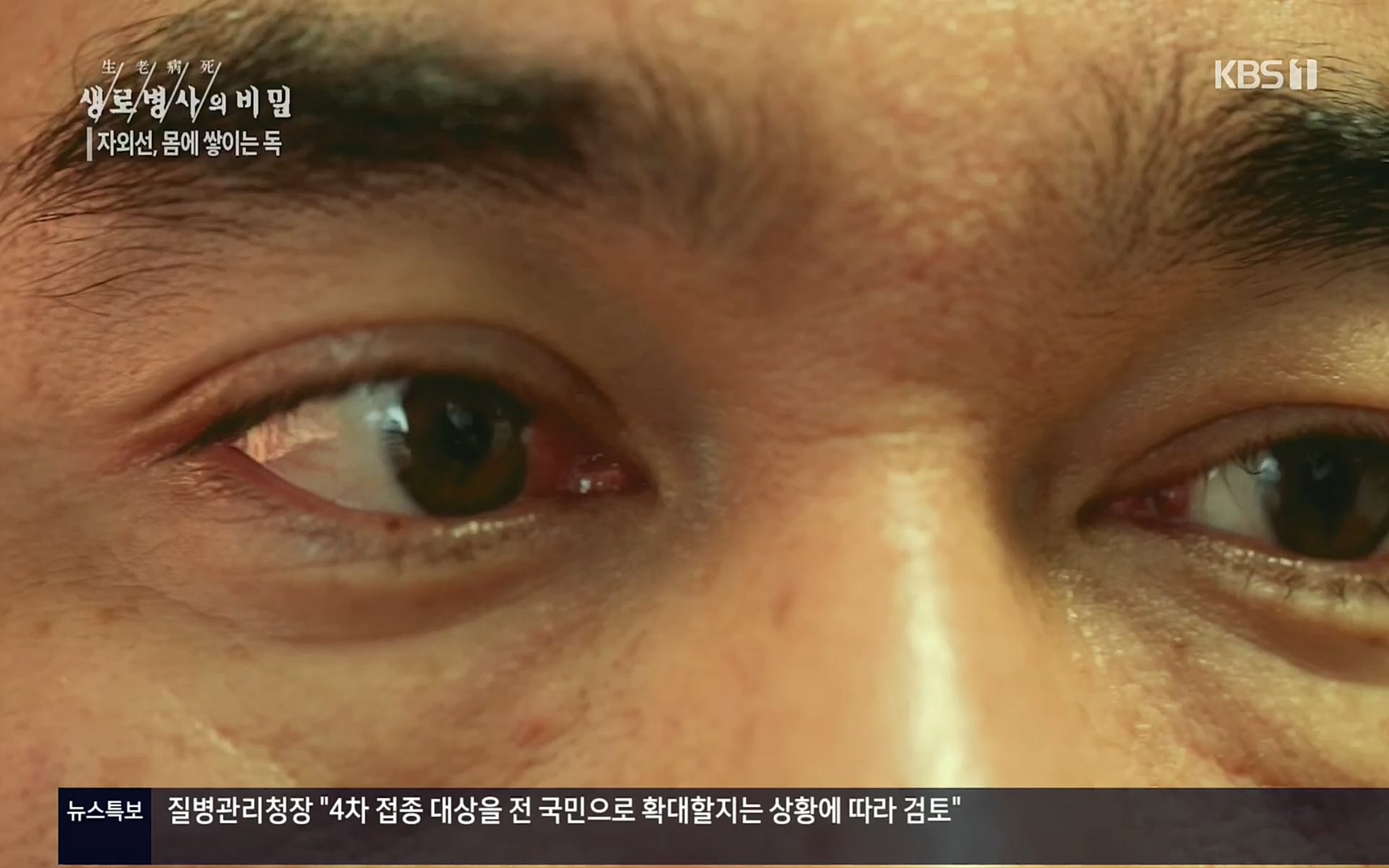 생로병사의 비밀.E824.220629p.H264-F1RST.mp4_20220630_205911.634.jpg