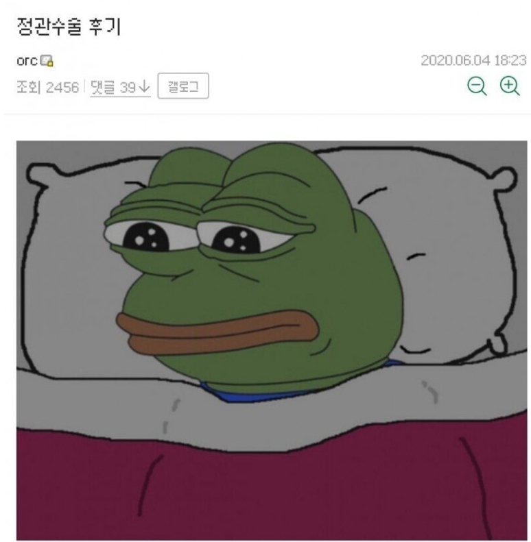  24살 정관수술 후기
