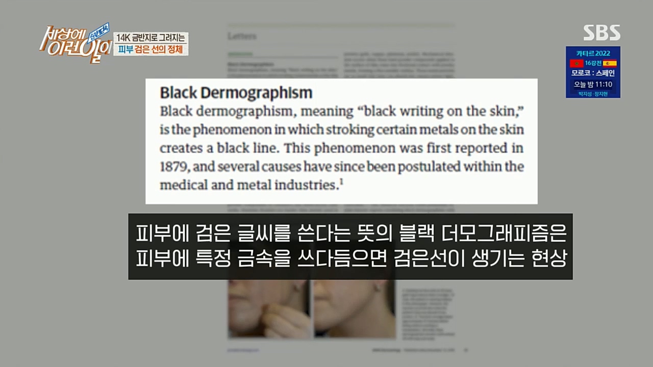 순간포착 세상에 이런일이.E1208.221207p.H264-F1RST.mp4_20221208_193120.898.jpg