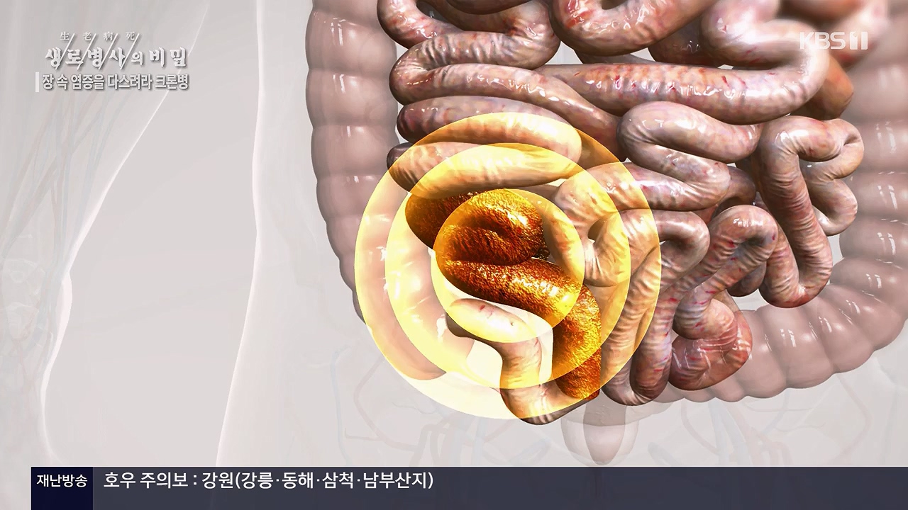 생로병사의 비밀.E884.230921p-NEXT.mp4_20230921_204733.576.jpg