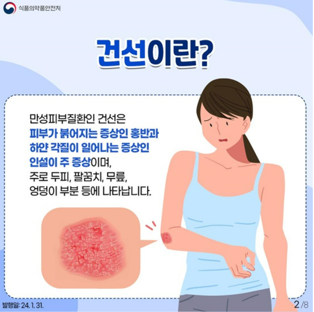 자가투여주사제 건선치료제