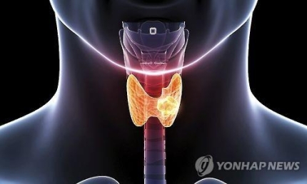 갑상선암 원인 증상 치료 방법 갑상선 6