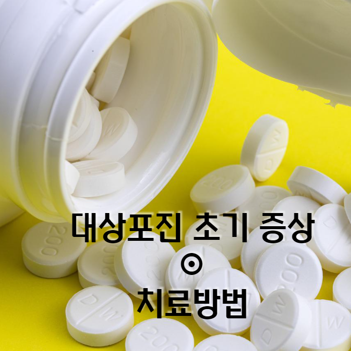  대상포진 실제 경험자가 말하는 초기 증상과 치료방법