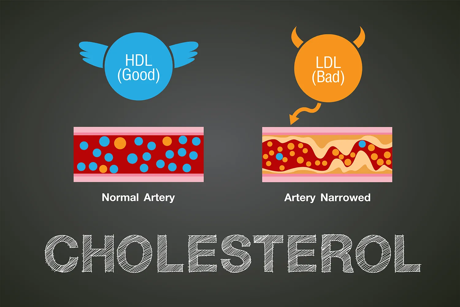 콜레스테롤이-혈관-건강에-미치는-영향-그래픽