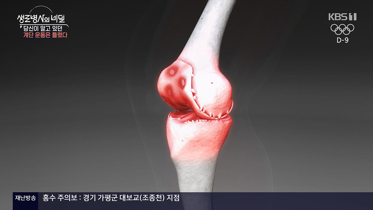 생로병사의 비밀.E920.240718p-NEXT.mp4_20240718_201550.533.jpg